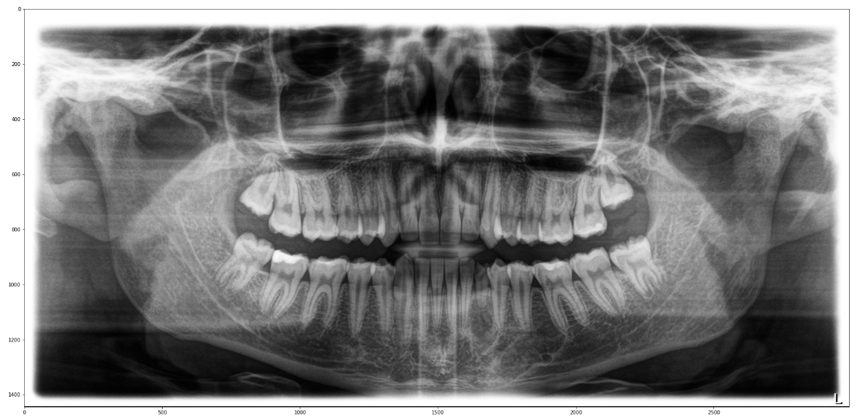 ML in Dental Imaging