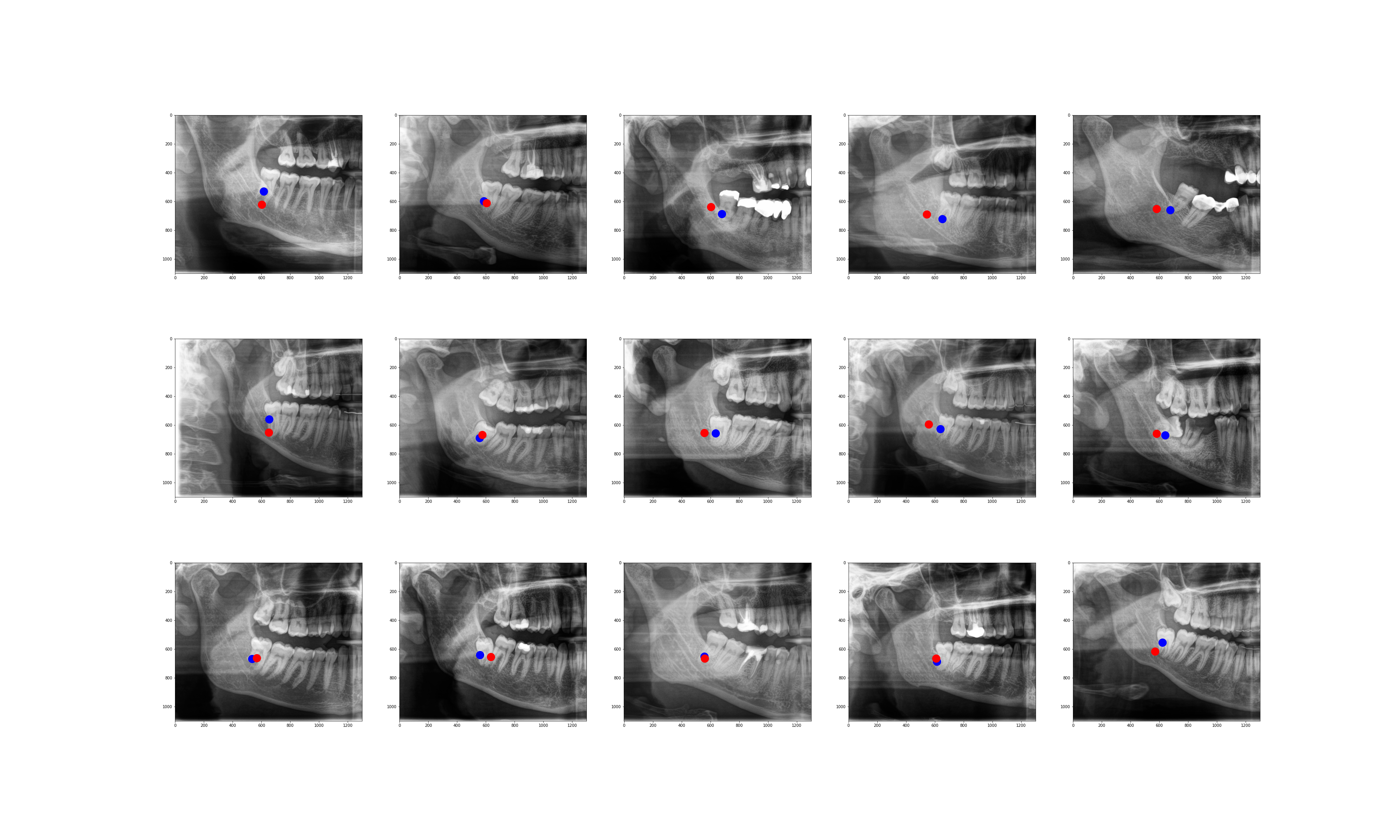 ML in Dental Imaging